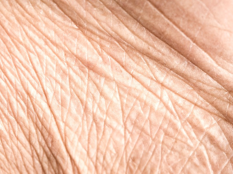 Wrinkled Skin