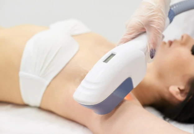 Laser hair removal is a versatile treatment that can effectively target unwanted hair on various parts of the body