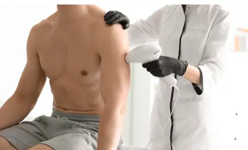 A man receiving a permanent laser hair removal treatment on his upper back by a Urban Body Laser professional, demonstrating the permanent back hair removal process of achieving a smooth, hair-free body.