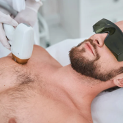 Urban Body Laser technician performing men’s chest hair removal with laser treatment in Vancouver.