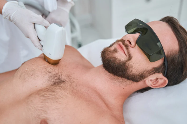 Urban Body Laser technician performing men’s chest hair removal with laser treatment in Vancouver.