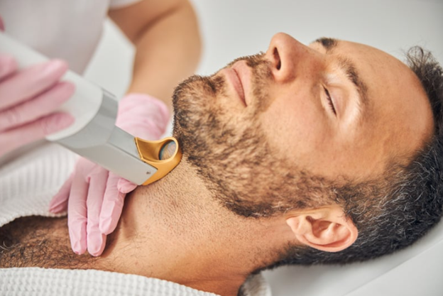 Urban Body Laser technician performing men’s facial and neck laser hair removal in Vancouver.