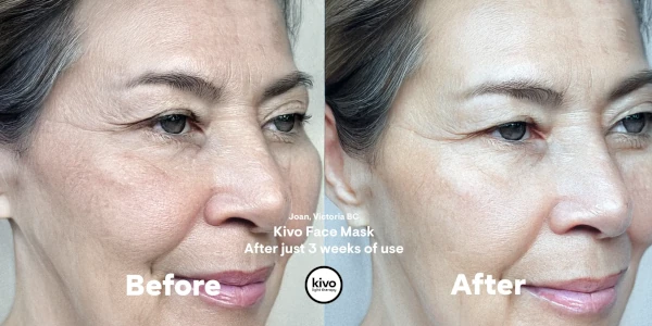 wrinkles-red-light-therapy