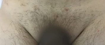 Balls 'n' All Before