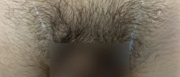 Balls 'n' All Before