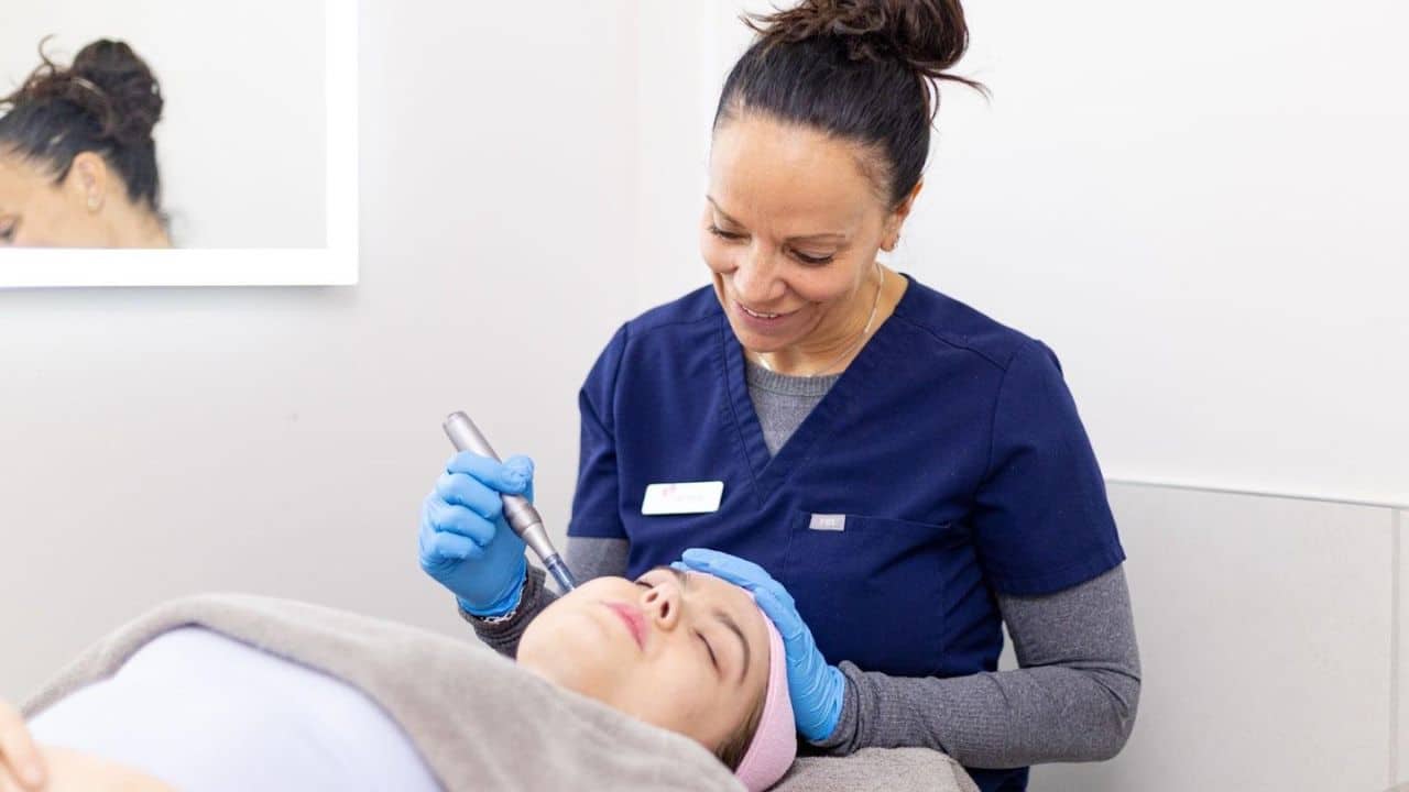 Microneedling treatment in progress to improve skin texture and glow