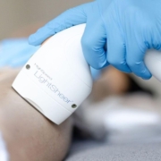 Laser hair removal device applied to a person’s leg by a technician wearing blue gloves in a clinical setting