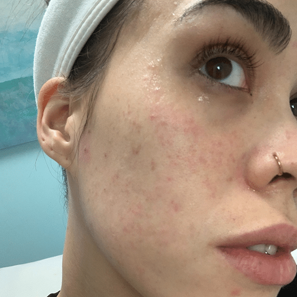 Before photo showing skin dullness