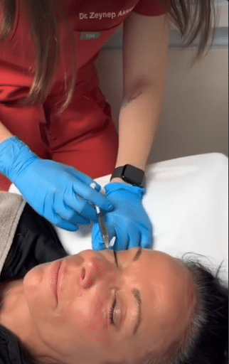 Woman undergoing through PRP Under Eye Treatment