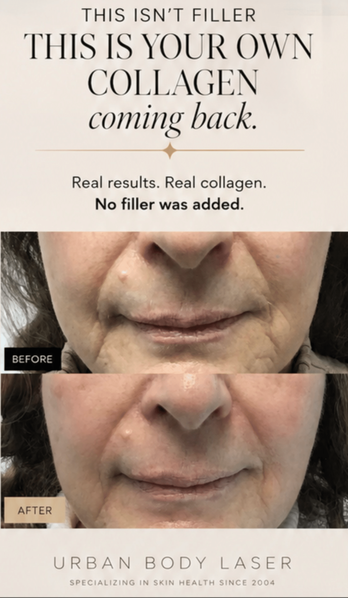 collagen stimulation before and after.